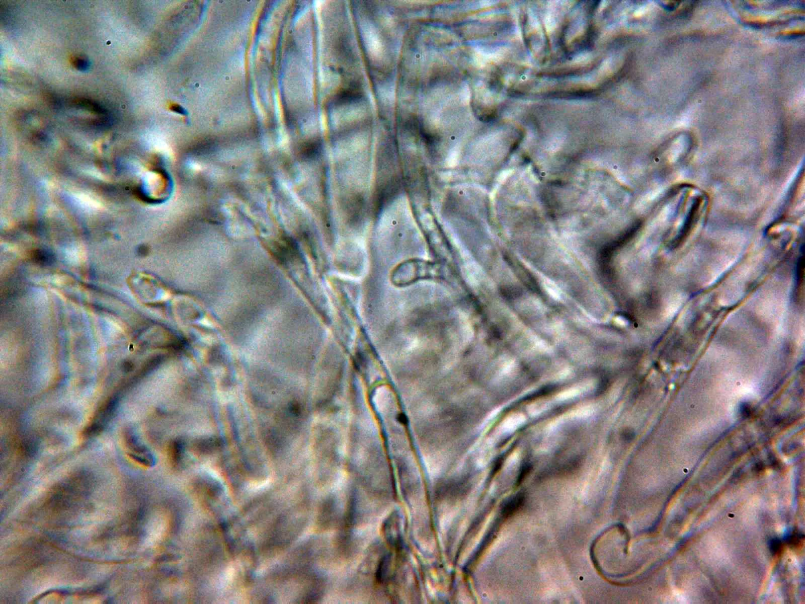 Microscopía de Russula virescens - 10 - Cutícula agua 3